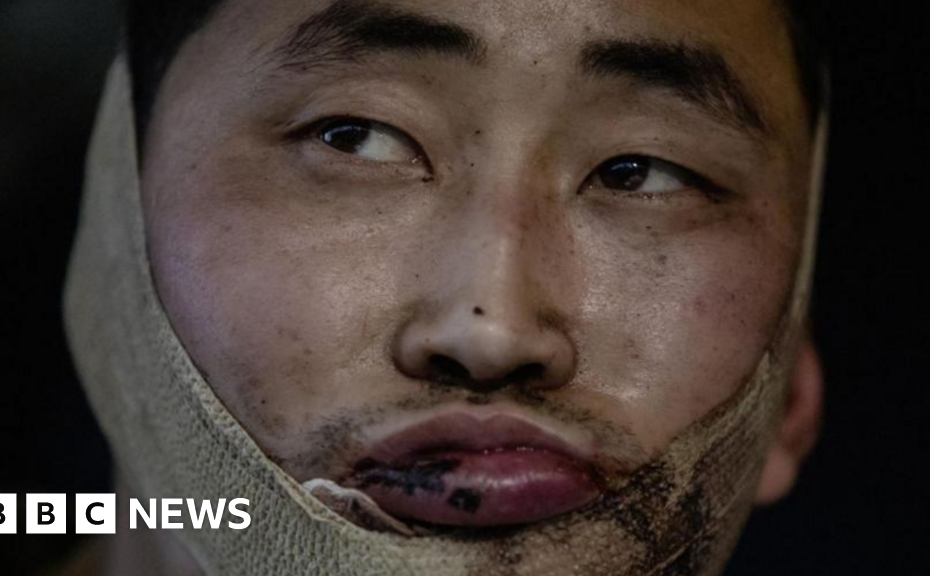 About 1,000 North Koreans killed in Kursk-Ukraine fighting, officials say