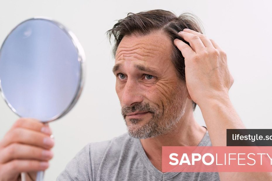 Com que idade a alopecia androgenética se estabiliza? - Fitness e bem-estar