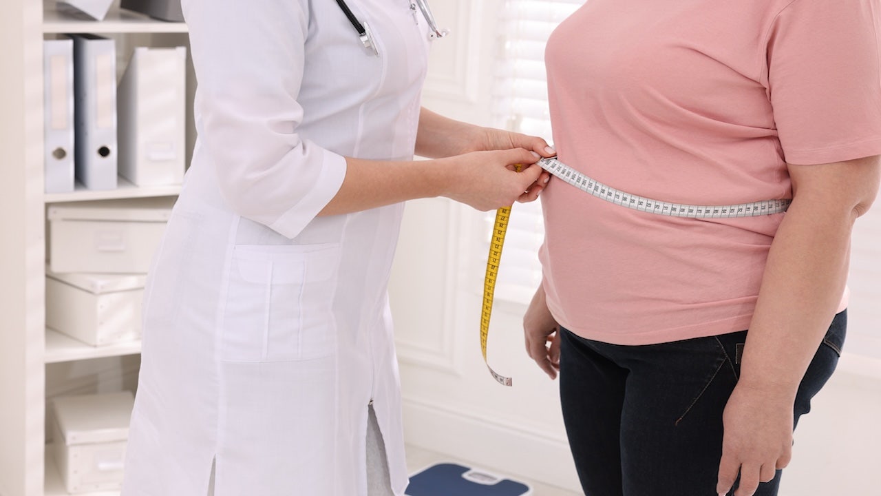 Experts say obesity is a 'complex' problem that goes beyond body mass index