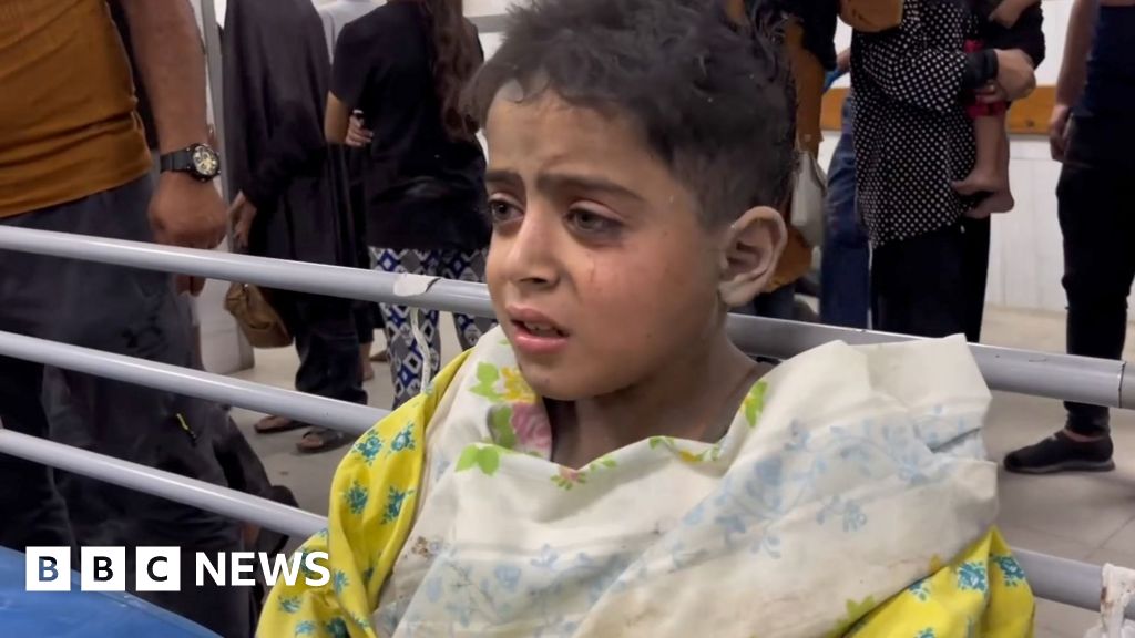 For Gaza survivors, war will last a long time