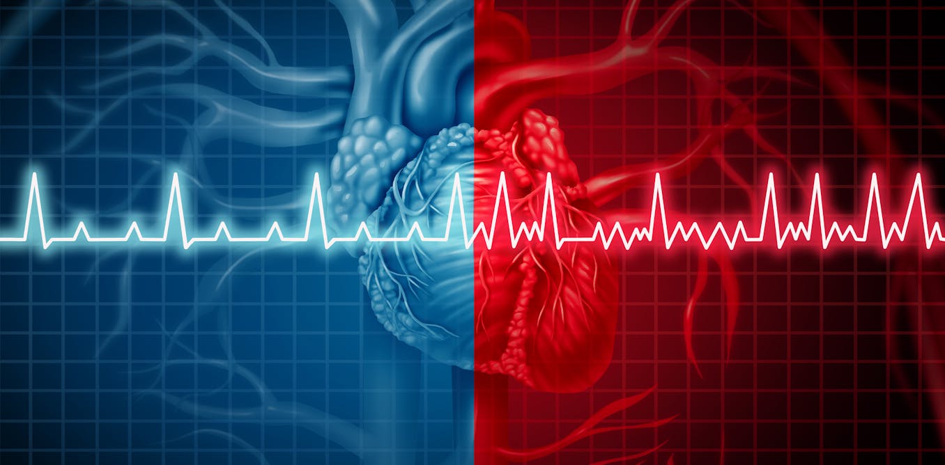 Why is obesity linked to irregular heartbeats? Researchers discovered a potential mechanism