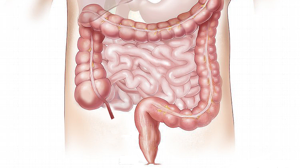 Os cientistas criam calculadora de saúde intestinal (muito fácil de usar)
