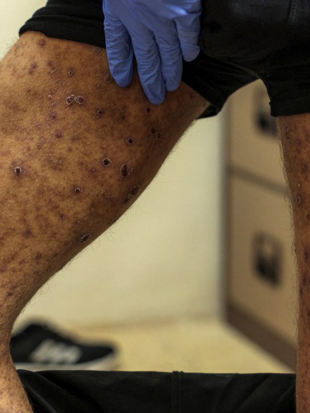 The Palestinians issued by Israeli showed signs of “torture, hunger” | Gaza News