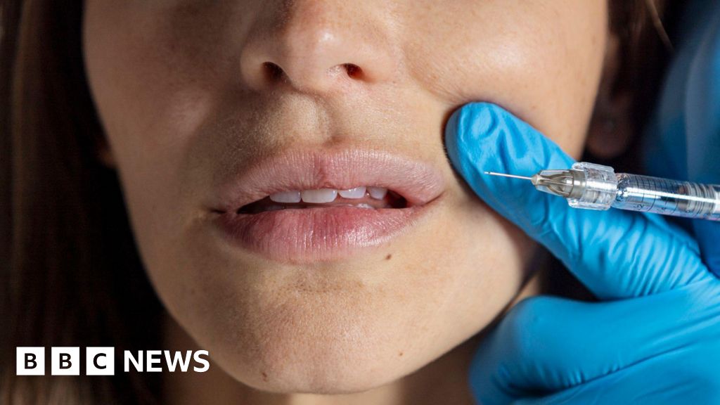 AI tools are used to test public opinion on botulinum toxins and fillers