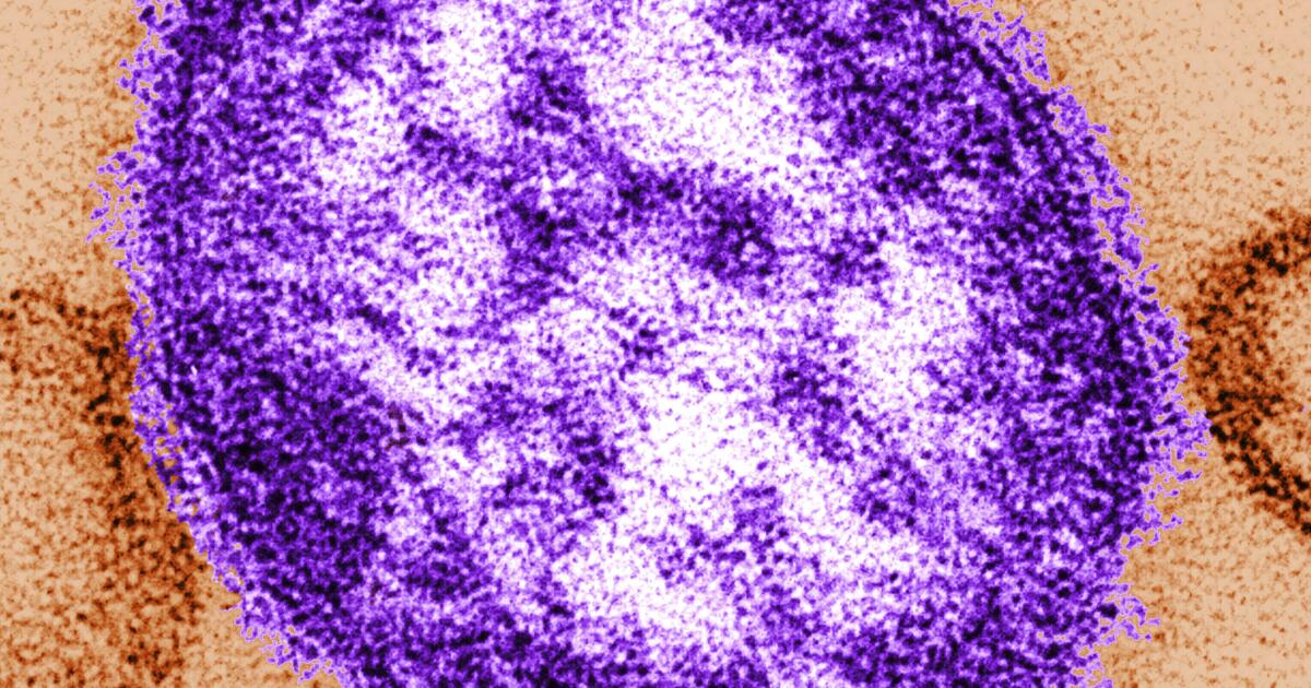 Another case of measles reported in Los Angeles County; Urges vaccination