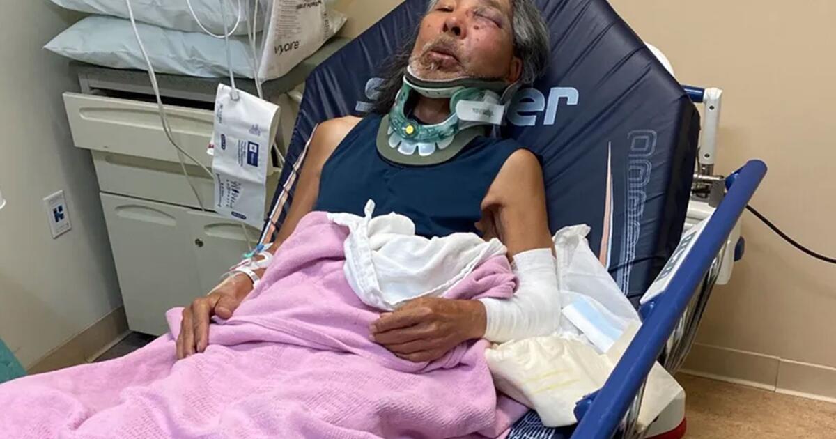 Asian American professor teaches history of racism with possible hate crime attacks