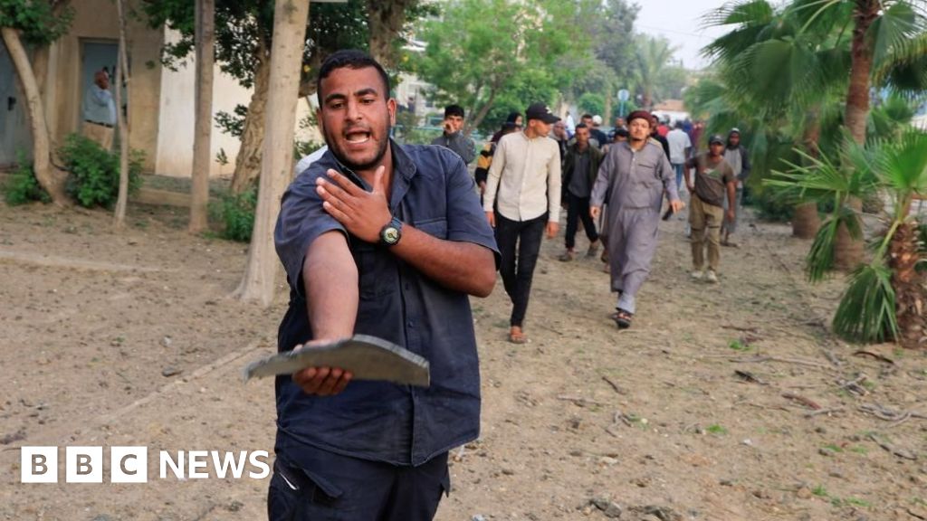 BBC photographer is troubled by malnourished Gaza children injured during Israel strike