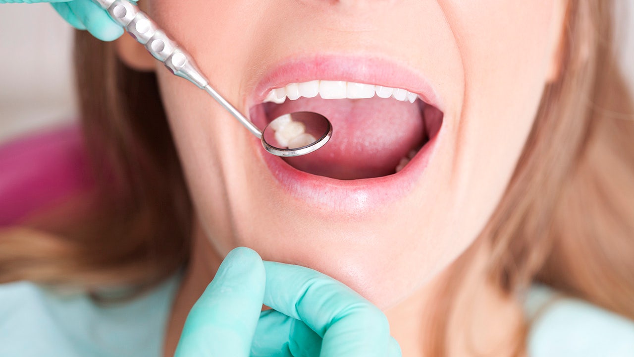 Cavity symptoms, causes and preventive methods to improve dental health