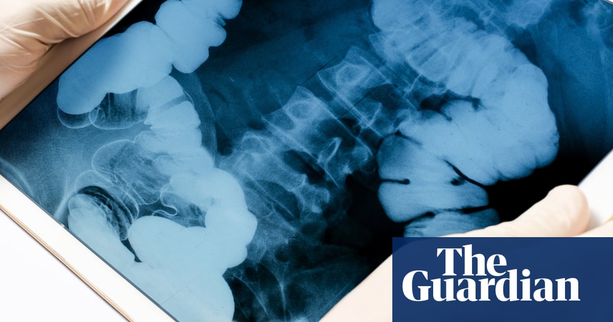 ICK factors that can save lives: U.S. cancer researchers seek medical treatment clues | U.S. News