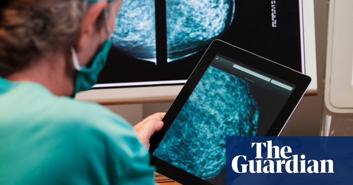 NHS England aims to treat cancer faster with new data tools | Cancer