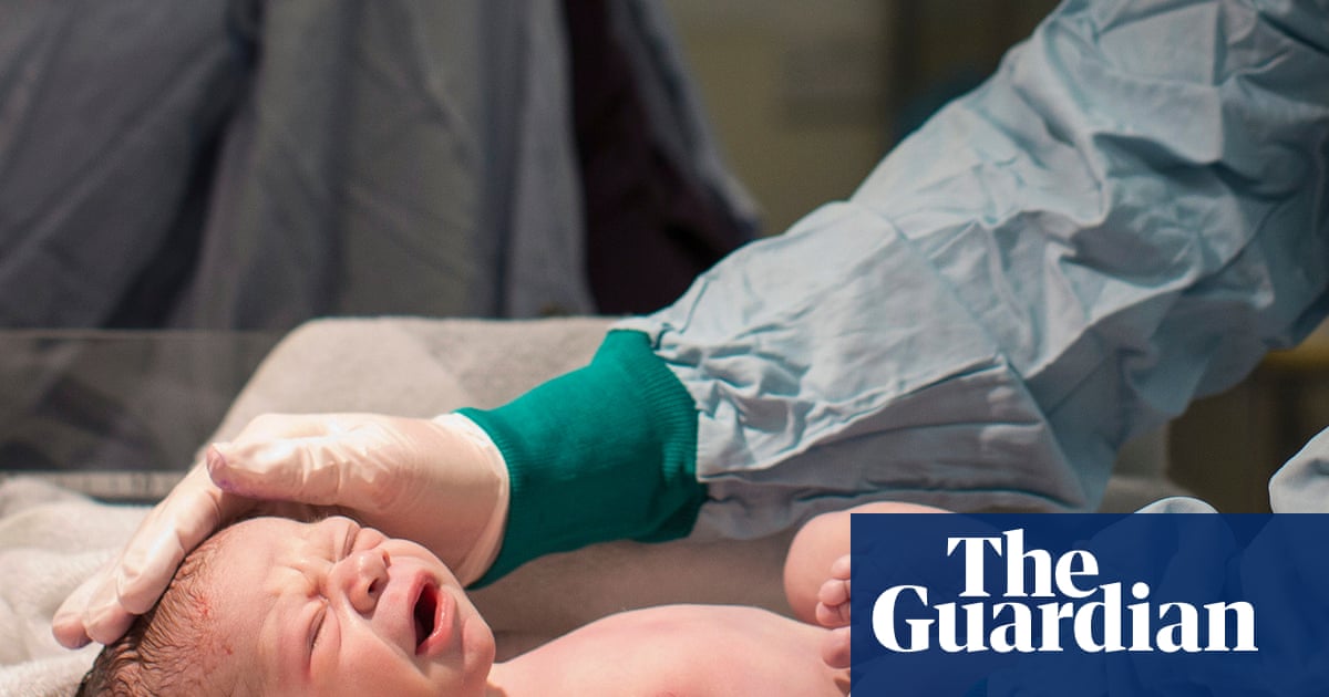 NHS Program Prevents Extended Delivery Brain Injury in England | NHS