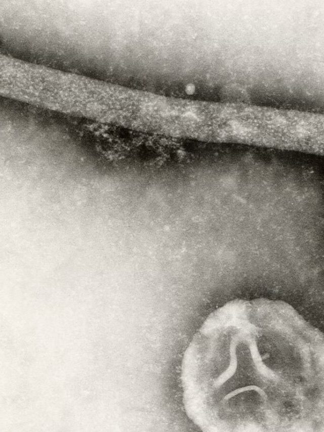O número de casos de influenza em humanos nos Estados Unidos caiu acentuadamente. Ninguém sabe por que