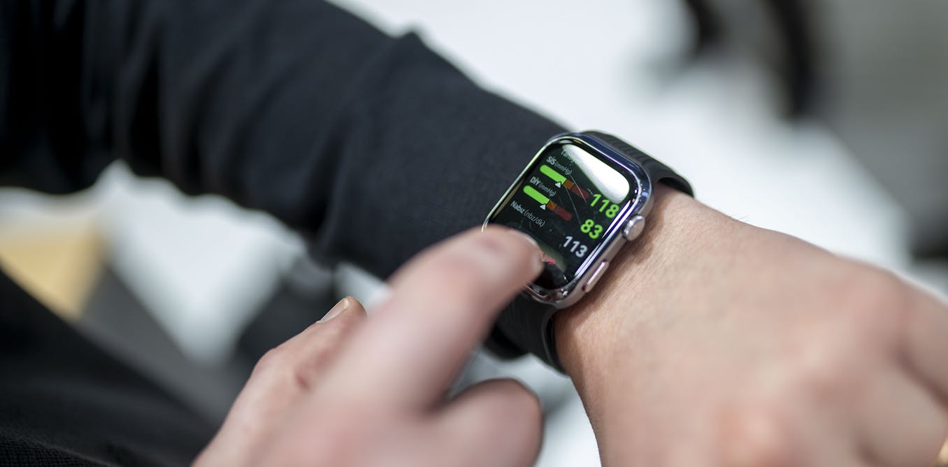 Smartwatches promise various quality of life improvements – Here are 5 things users should remember