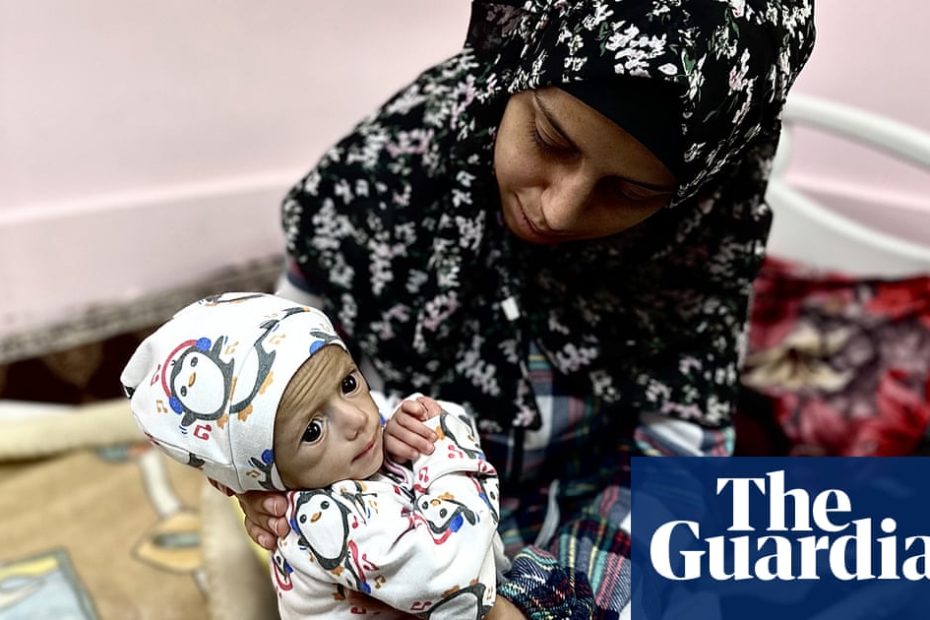 The mother of a skinny baby girl trapped in Gaza says pain everywhere | Israel's Gaza War