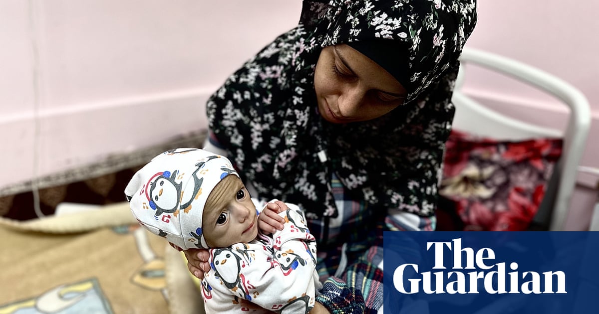 The mother of a skinny baby girl trapped in Gaza says pain everywhere | Israel's Gaza War