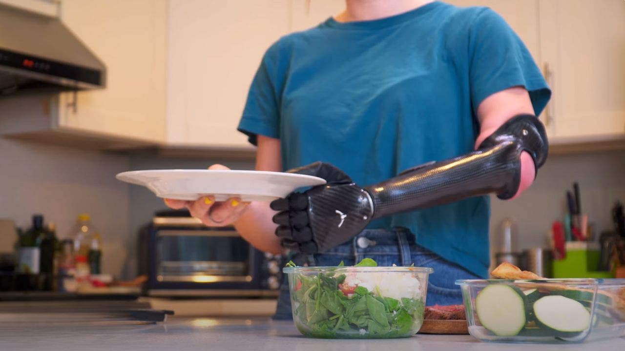 The world's first bionic hand with lightning reaction