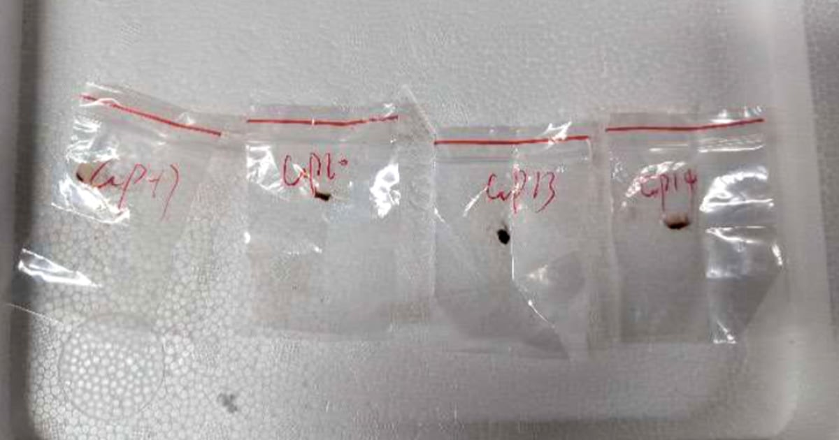 Chinese couple accused of smuggling biological pathogens to the United States