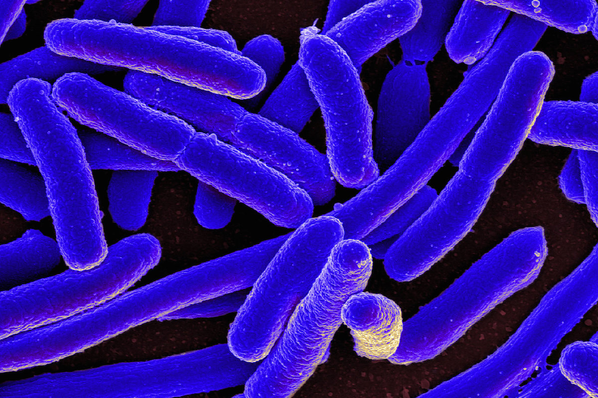 Escherichia coli mata vírus usando técnicas antigas de guerra
