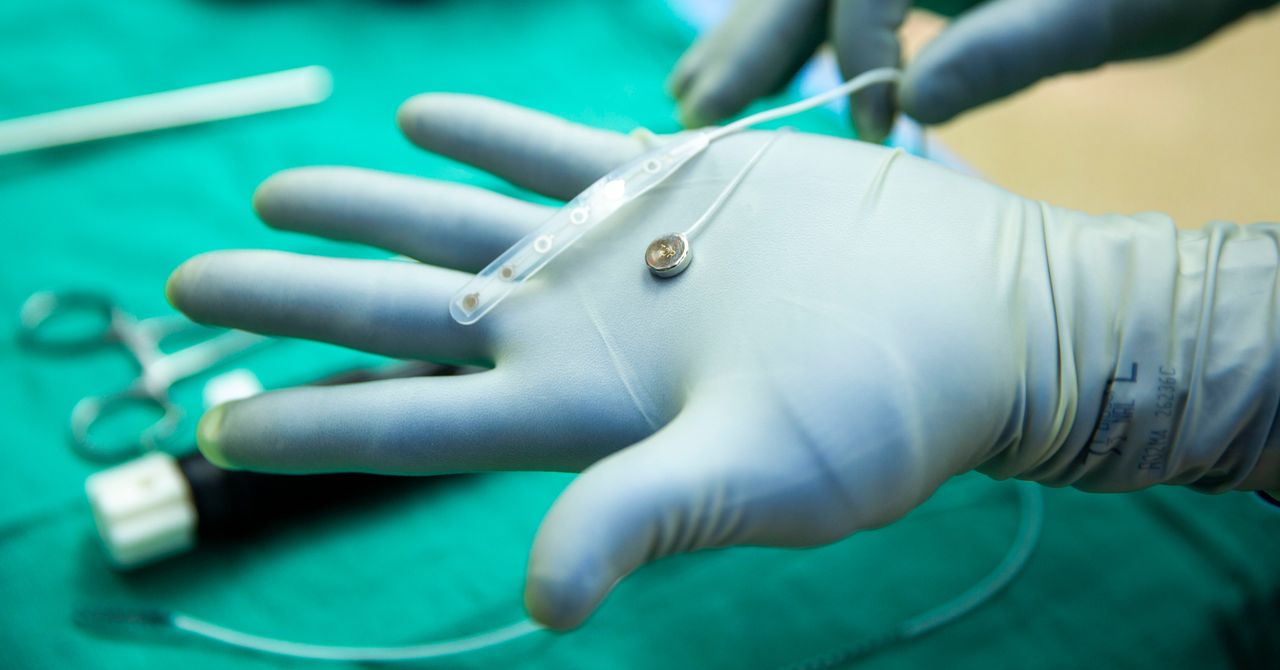 Neural Internet competitors just tested brain implants in one person