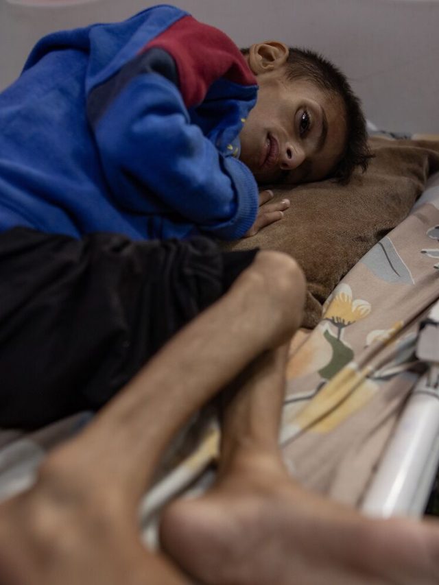 Osama, 5 anos 9 libras. Uma geração de rostos terá problemas sérios de saúde