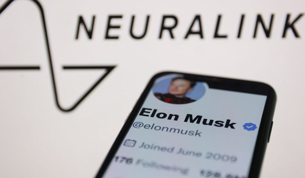 The first Neuralink brain implant patient thanks Elon Musk for life-changing technology